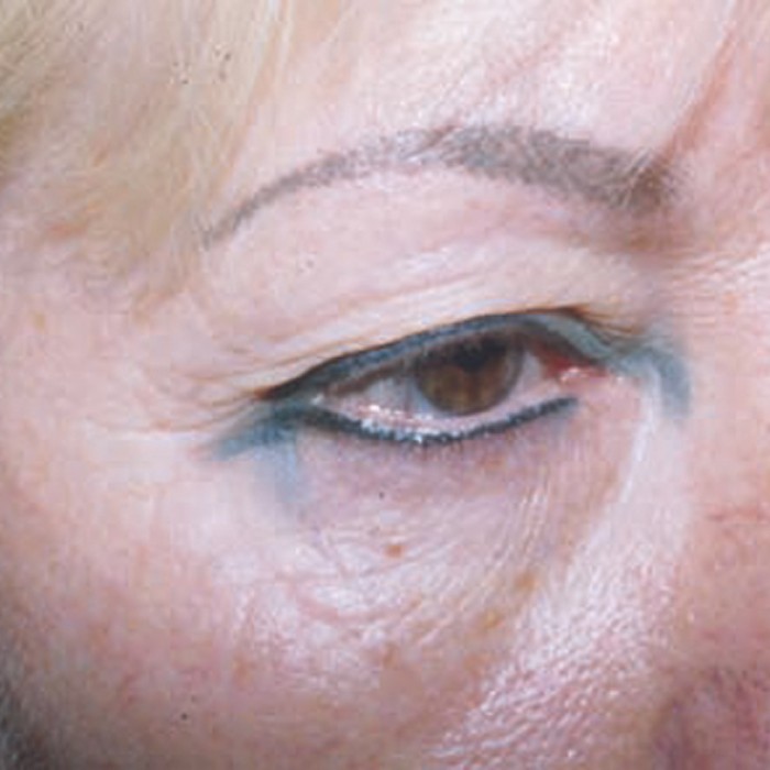 pokazené PMU z iného salónu - riešenia